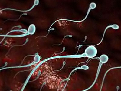 Γονιμότητα: Δύο συνηθισμένες παθήσεις του σπέρματος, Μέρος 2ο